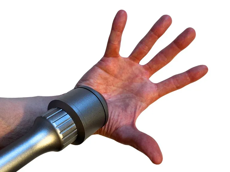 Laser Treatment on Hand