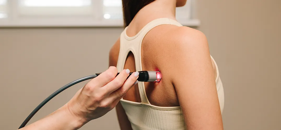 Laser Treatment
